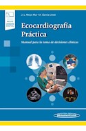 Papel Ecocardiografía Práctica