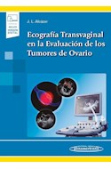 Papel Ecografía Transvaginal En La Evaluación De Los Tumores De Ovario