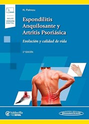 Papel Espondilitis Anquilosante Y Artritis Psoriásica