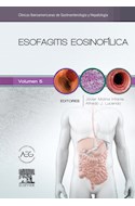 E-book Esofagitis Eosinofílica