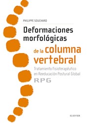 E-book Deformaciones Morfológicas De La Columna Vertebral