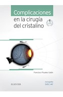 E-book Complicaciones En La Cirugía Del Cristalino (Ebook)