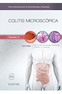E-book Colitis Microscópica