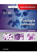 E-book Patología Pulmonar