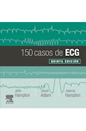 Papel 150 Casos De Ecg Ed.5