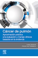 E-book Cáncer De Pulmón