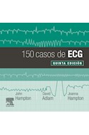 E-book 150 Casos De Ecg