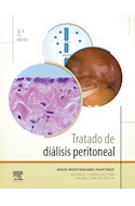E-book Tratado De Diálisis Peritoneal
