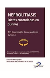  Nefrolitiasis. Dietas controladas en purinas