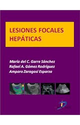  Lesiones focales hepáticas