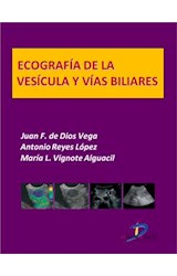  Ecografía de la vesícula y vías biliares