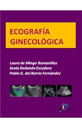  Ecografía ginecológica