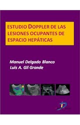  Estudio Doppler de las lesiones ocupantes de espacio hepáticas