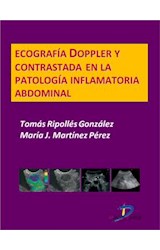  Ecografía Doppler y contrastada en la patología inflamatoria abdominal