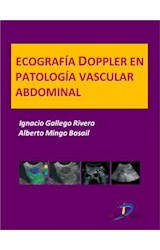  Ecografía Doppler en Patología vascular abdominal
