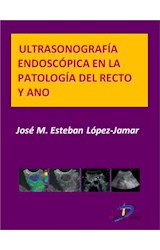  Ultrasonografía endoscópica en la patología del recto y ano