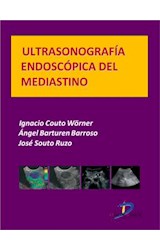  Ultrasonografía endoscópica del mediastino