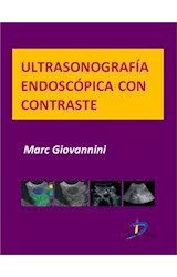  Ultrasonografía endoscópica con contraste