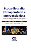 Papel Ecocardiografía Intraoperatoria E Intervencionista