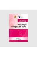 Papel Patología Benigna De Vulva