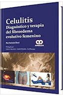 Papel Celulitis