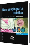 Papel Neuroangiografía Práctica