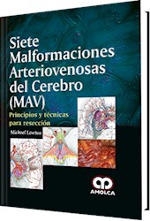Papel Siete Malformaciones Arteriovenosas Del Cerebro (Mav) – Principios Y Técnicas Para Resección