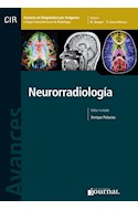 Papel Avances En Diagnóstico Por Imágenes: Neurorradiología