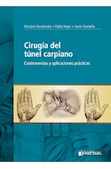 Papel Cirugía Del Túnel Carpiano