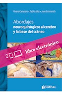 E-Book Abordajes Neuroquirúrgicos Al Cerebro Y La Base Del Cráneo (Ebook)