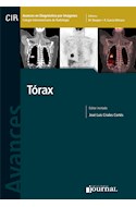 E-Book Avances En Diagnóstico Por Imágenes: Tórax (Ebook)