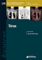 E-Book Avances En Diagnóstico Por Imágenes: Tórax (Ebook)