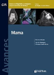 E-Book Avances En Diagnóstico Por Imágenes: Mama  E-Book