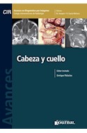 E-Book Avances En Diagnóstico Por Imágenes: Cabeza Y Cuello (Ebook)