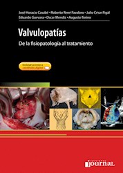 Papel Valvulopatías