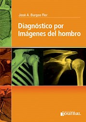 E-Book Diagnóstico Por Imágenes Del Hombro  E-Book