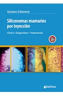 Papel Siliconomas Mamarios Por Inyección