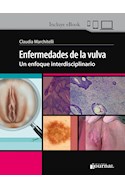 Papel Enfermedades De La Vulva