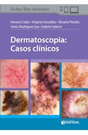 E-Book Dermatoscopia: Casos Clínicos (Ebook)