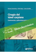 E-Book Cirugía Del Túnel Carpiano (Ebook)