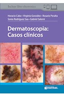 Papel+Digital Dermatoscopia: Casos Clínicos