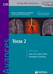 E-Book Avances En Diagnóstico Por Imágenes: Tórax 2 (E-Book)