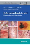 E-Book Enfermedades De La Piel (Ebook)