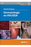 Papel Dermatología En Vih/Sida