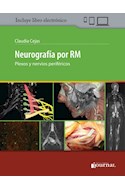 E-Book Neurografía Por Rm (Ebook)