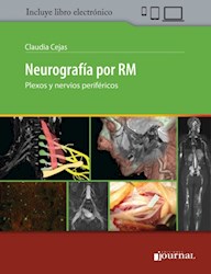 E-Book Neurografía Por Rm (E-Book)