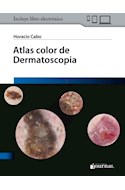 E-Book Atlas Color De Dermatoscopia (Ebook)