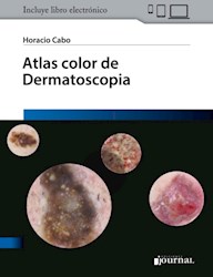 E-Book Atlas Color De Dermatoscopia (Ebook)