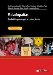 E-Book Valvulopatías (Ebook)