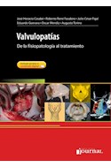 E-Book Valvulopatías (Ebook)